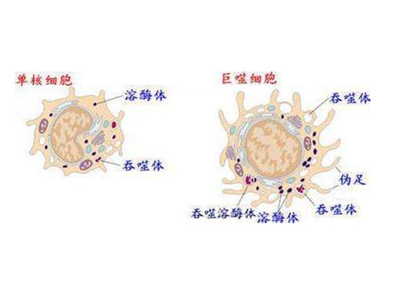 Read more about the article 我国学者发现炎症巨噬细胞凋亡机制