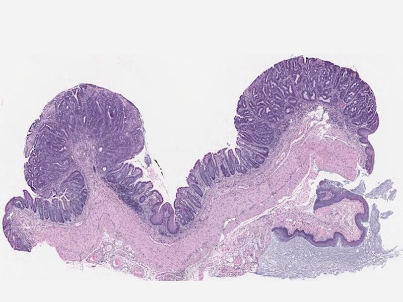 Read more about the article 肠道类器官移植快速形成结直肠癌小鼠模型