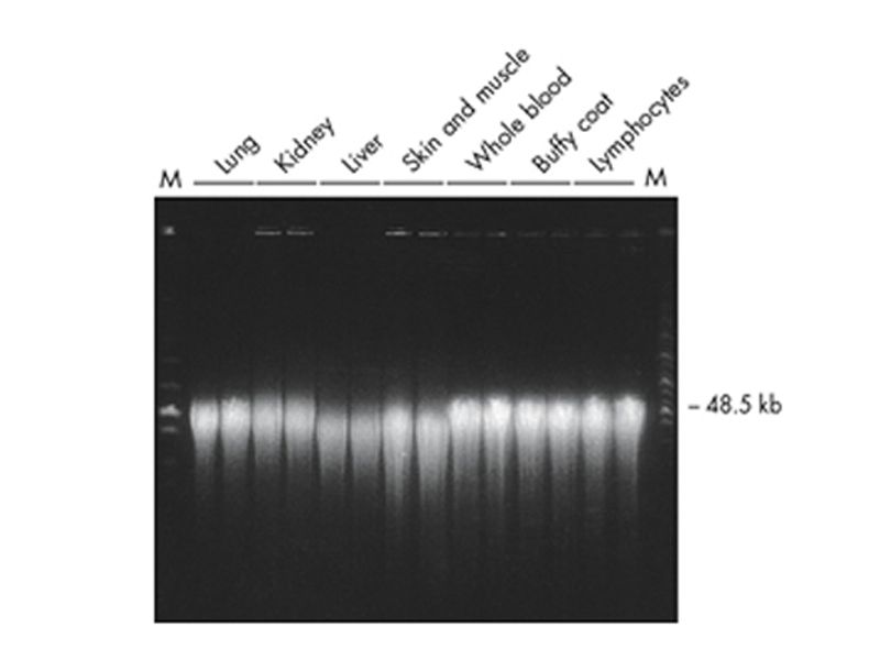 Read more about the article 常规组织样本核酸（DNA/RNA）提取纯化